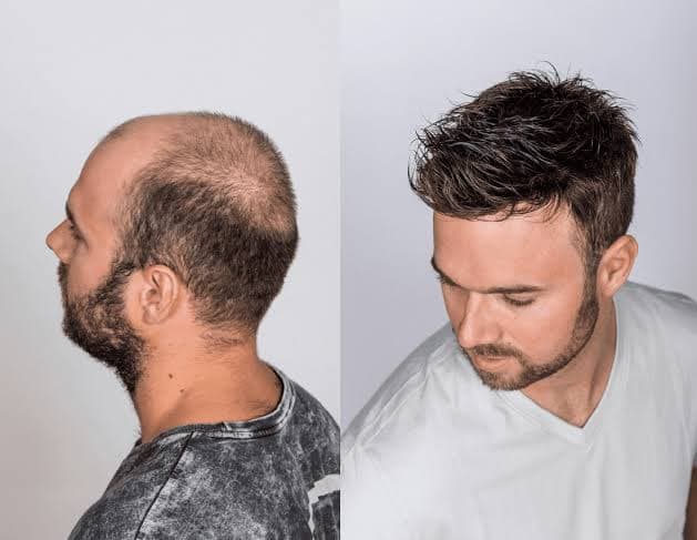 Man with a full, textured hair system styled away from his face